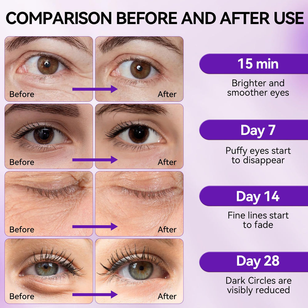 BREYLEE Retinol Eye Mask cooling effect aids quick recovery after long day.