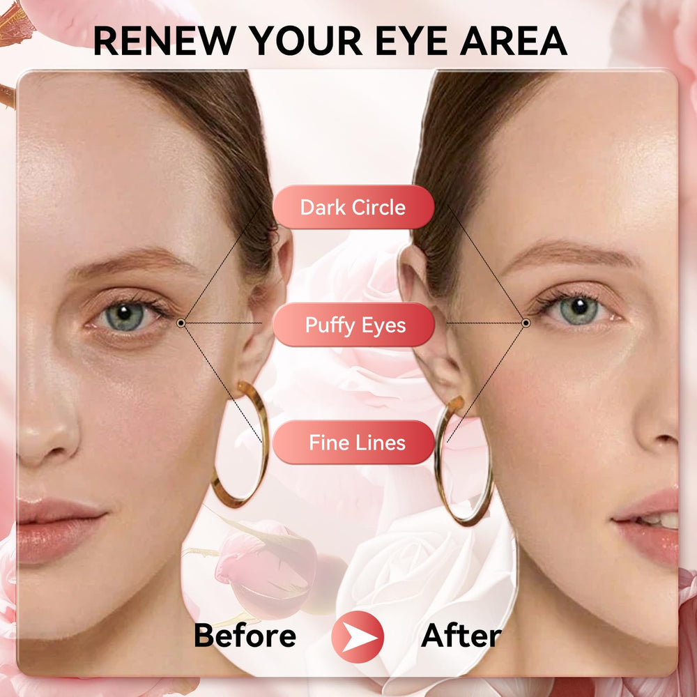 BREYLEE rose eye mask helps brighten the eye area with continued use