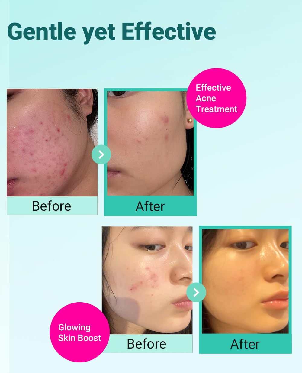 BRING GREEN Deep Cleansing Foam dense lather for pore cleansing without stripping moisture.