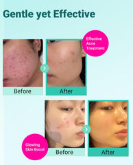 BRING GREEN Deep Cleansing Foam dense lather for pore cleansing without stripping moisture.