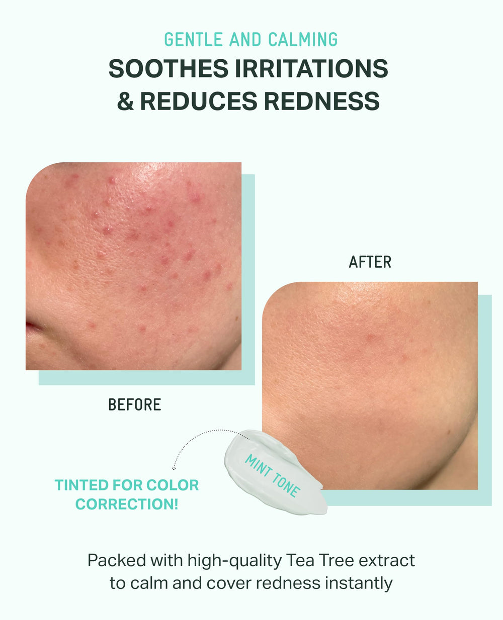 BRING GREEN Tea Tree CICA Mineral Sunscreen packaging box