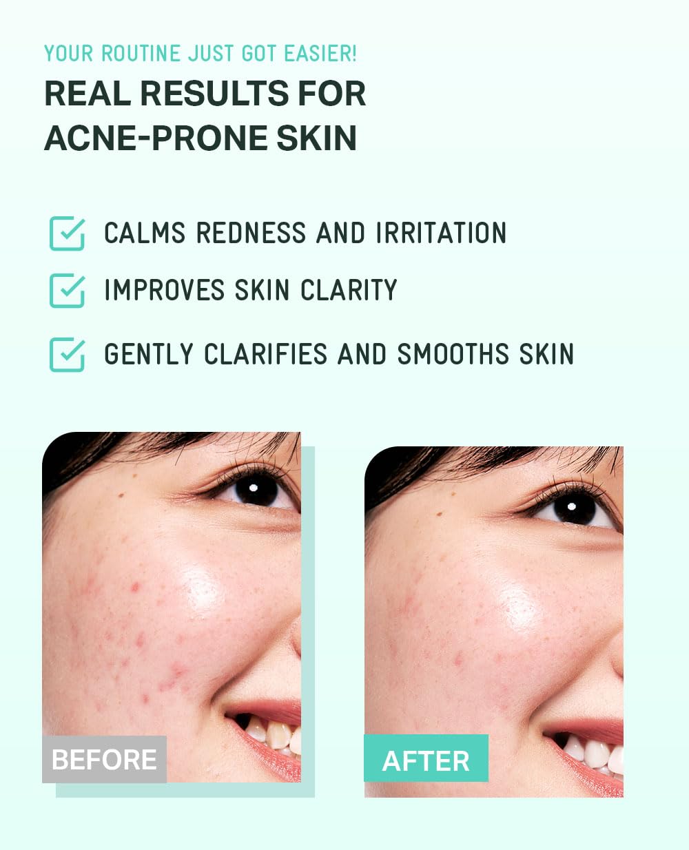 BRING GREEN Tea Tree CICA Toner packaging outer view