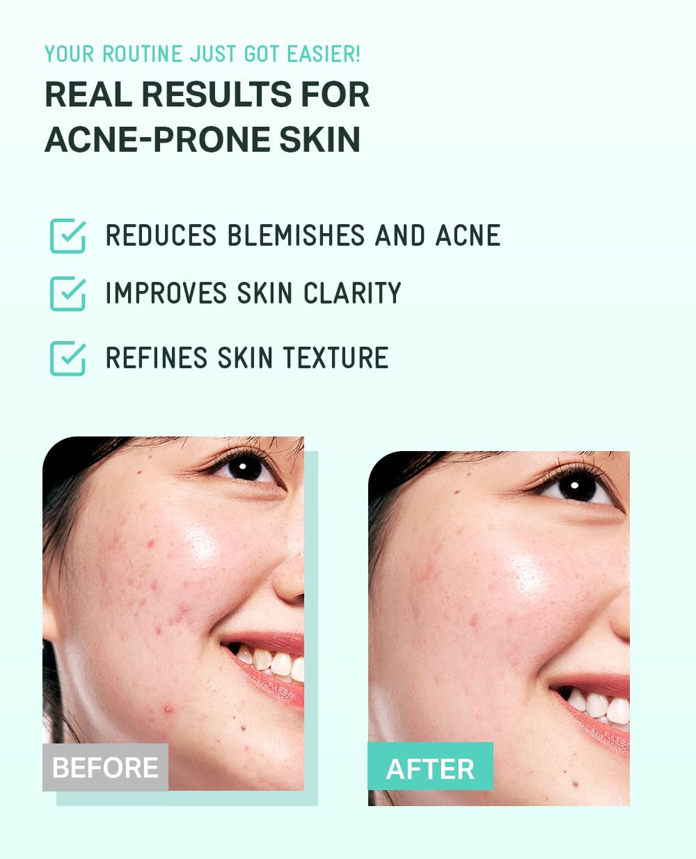 BRING GREEN Tea Tree Complex closeup reveals natural ingredients in the formula.
