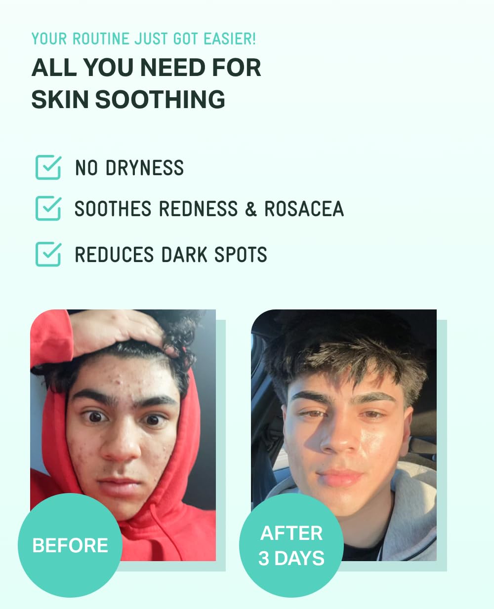 BRING GREEN Zinc Teca serum application steps image suggests easy daily use