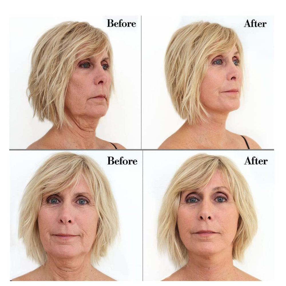 Bring It Up hypoallergenic medical-grade adhesive stays secure without irritation.