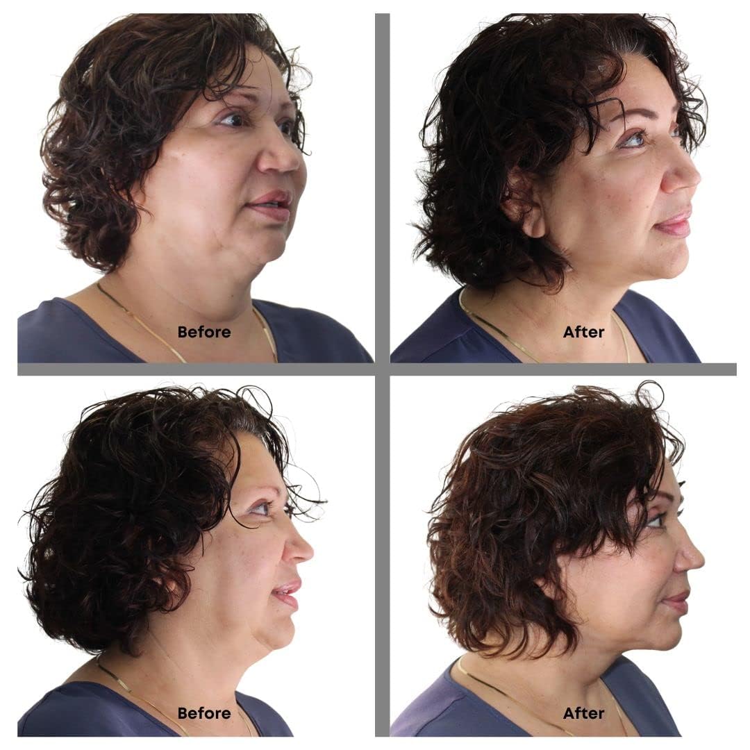 Bring It Up neck lift tape on the neck during application demonstrates discreet, near-invisible support.