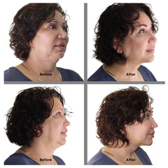 Bring It Up neck lift tape on the neck during application demonstrates discreet, near-invisible support.