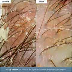 Briogeo Scalp Revival hydration mask texture ready for use for balanced moisture