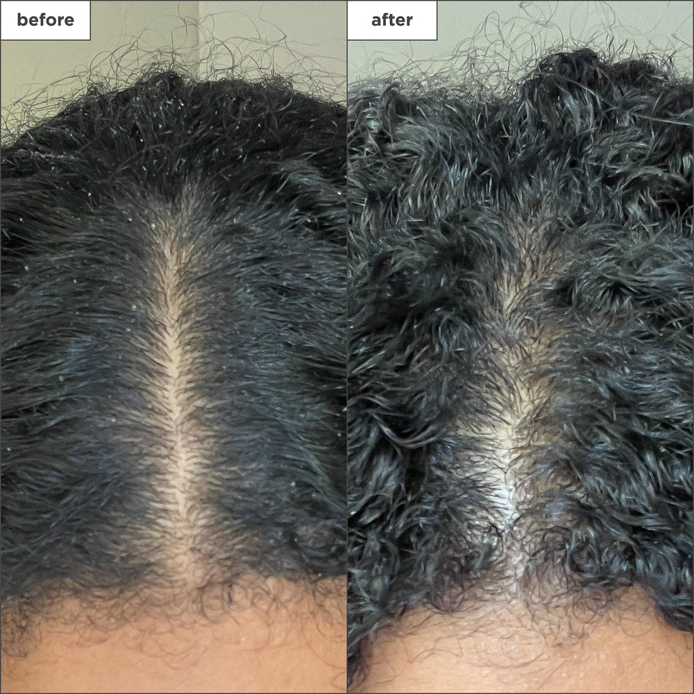 Briogeo Scalp Revival mint cooling sensation on the scalp