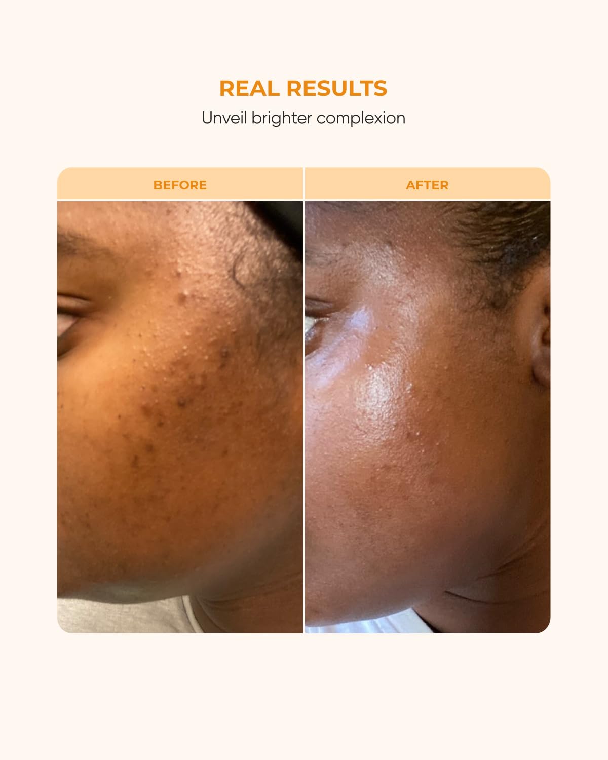 buttah. vitamin c serum with ferulic acid brightening support