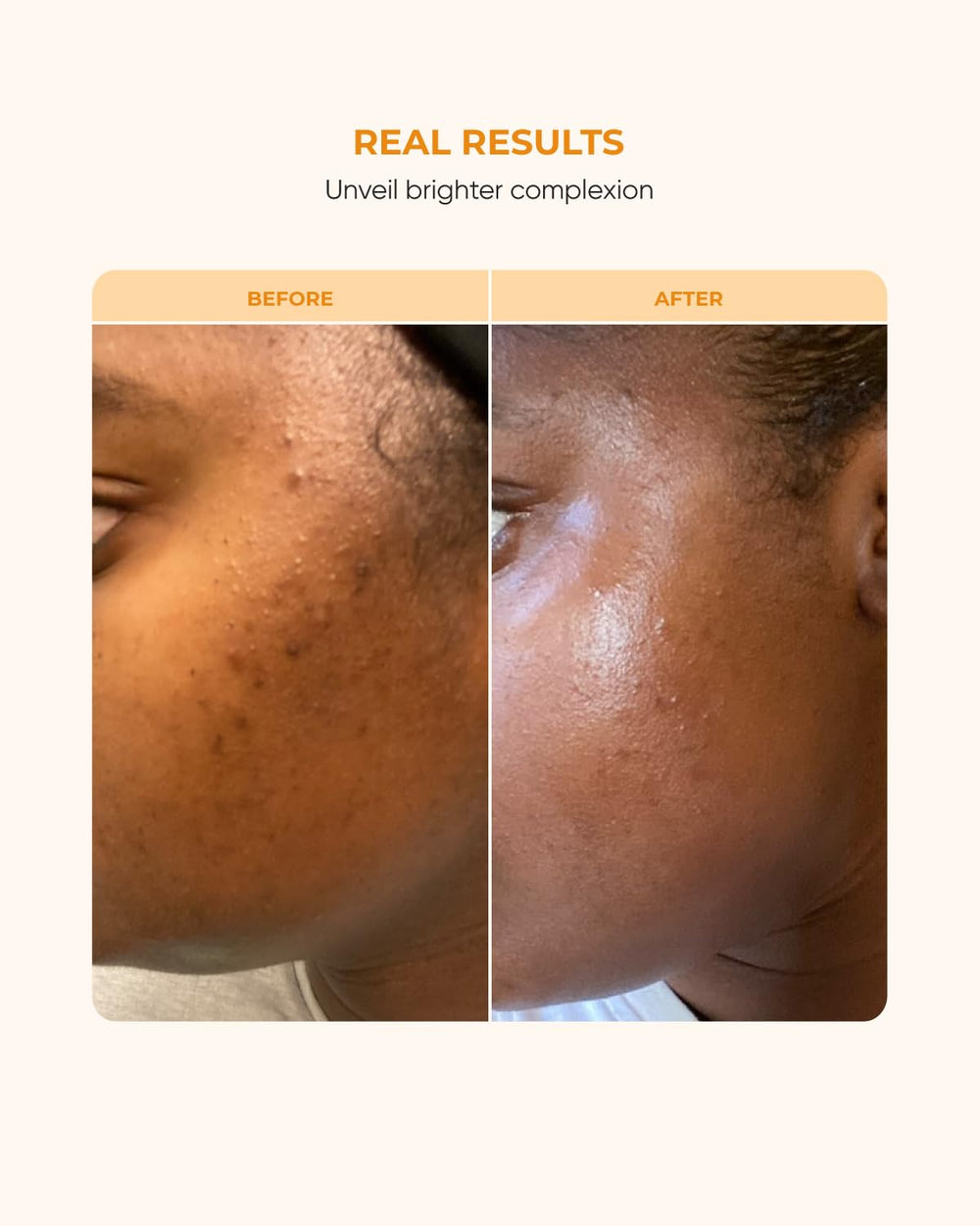 buttah. vitamin c serum with ferulic acid brightening support