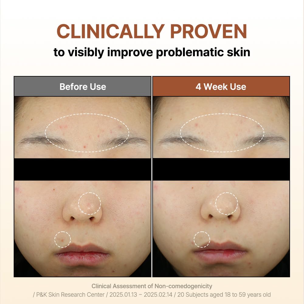 BY WISHTREND Mandelic Acid 5% Skin Prep Water bottle with label emphasizes reliable formulation