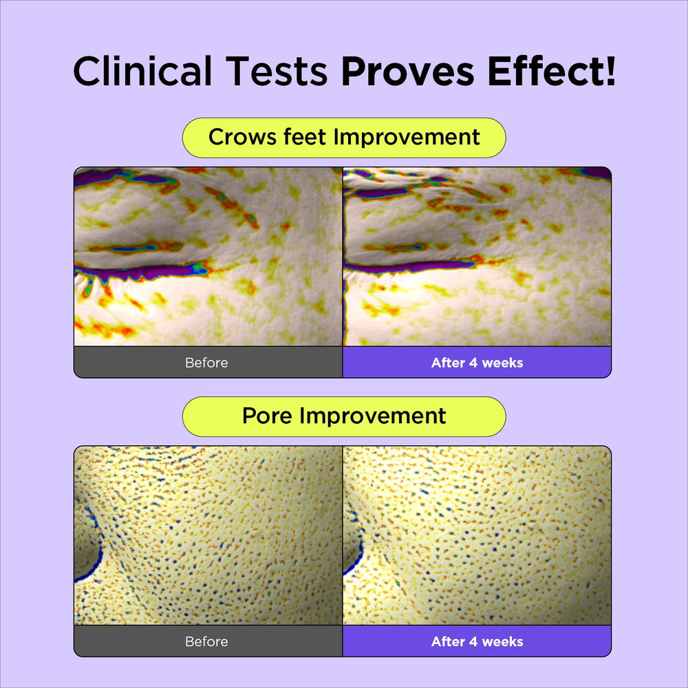 BY WISHTREND Pore-smoothing action depiction for improved texture