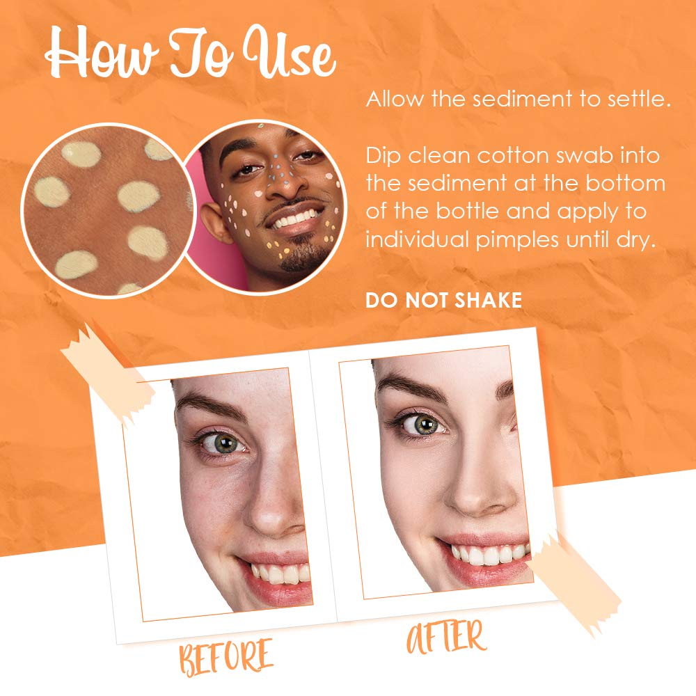 Bye Bye Blemish lotion close-up shows creamy texture gentle on sensitive skin
