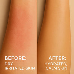 by.H aloe vera gel applied to sun-exposed skin