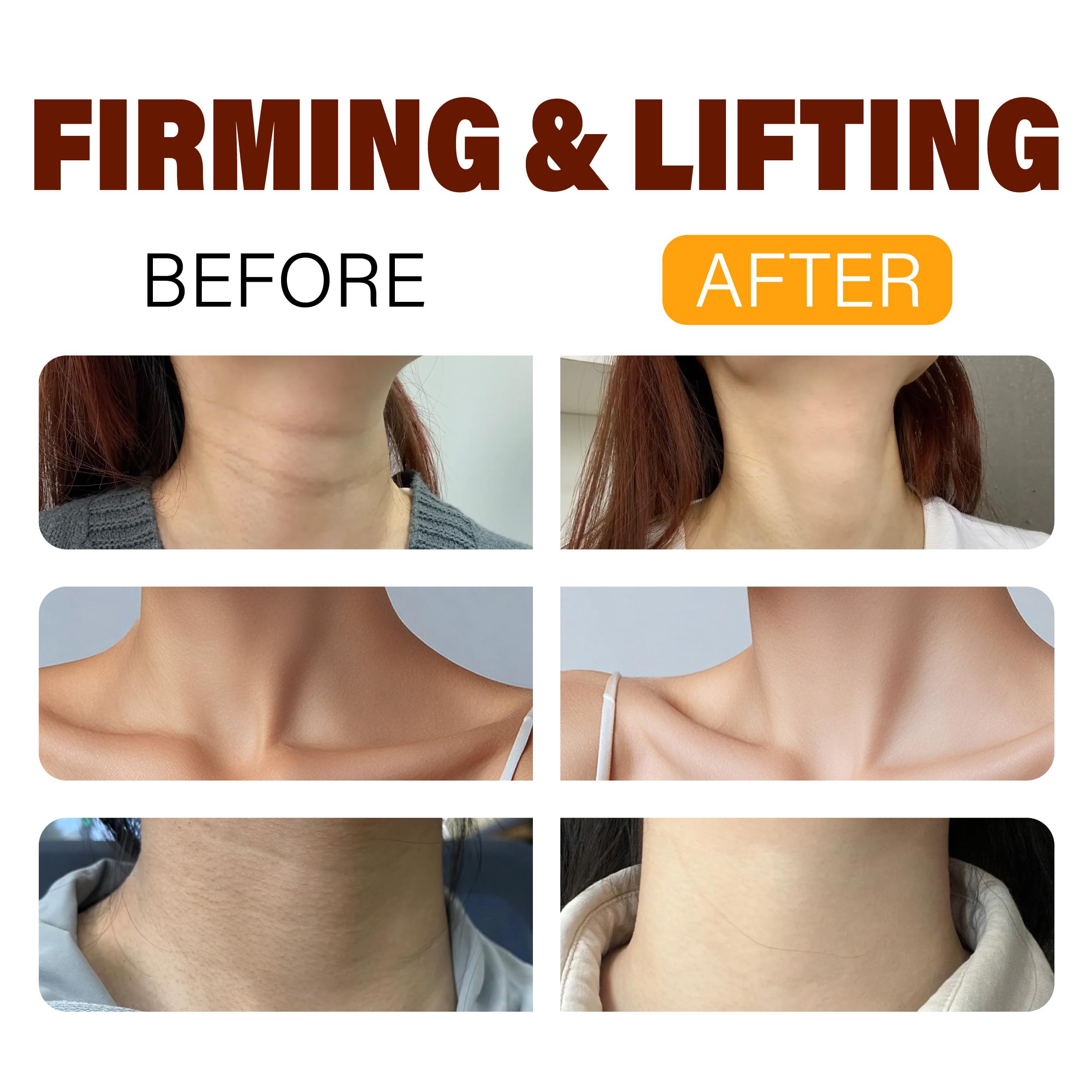 BYMOLIA Neck Roller Application showing dual rollers for massage.