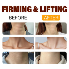 BYMOLIA Neck Roller Application showing dual rollers for massage.