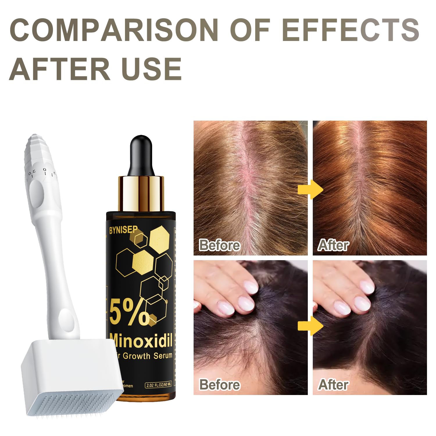 BYNISEP biotin and plant extracts formulation close-up
