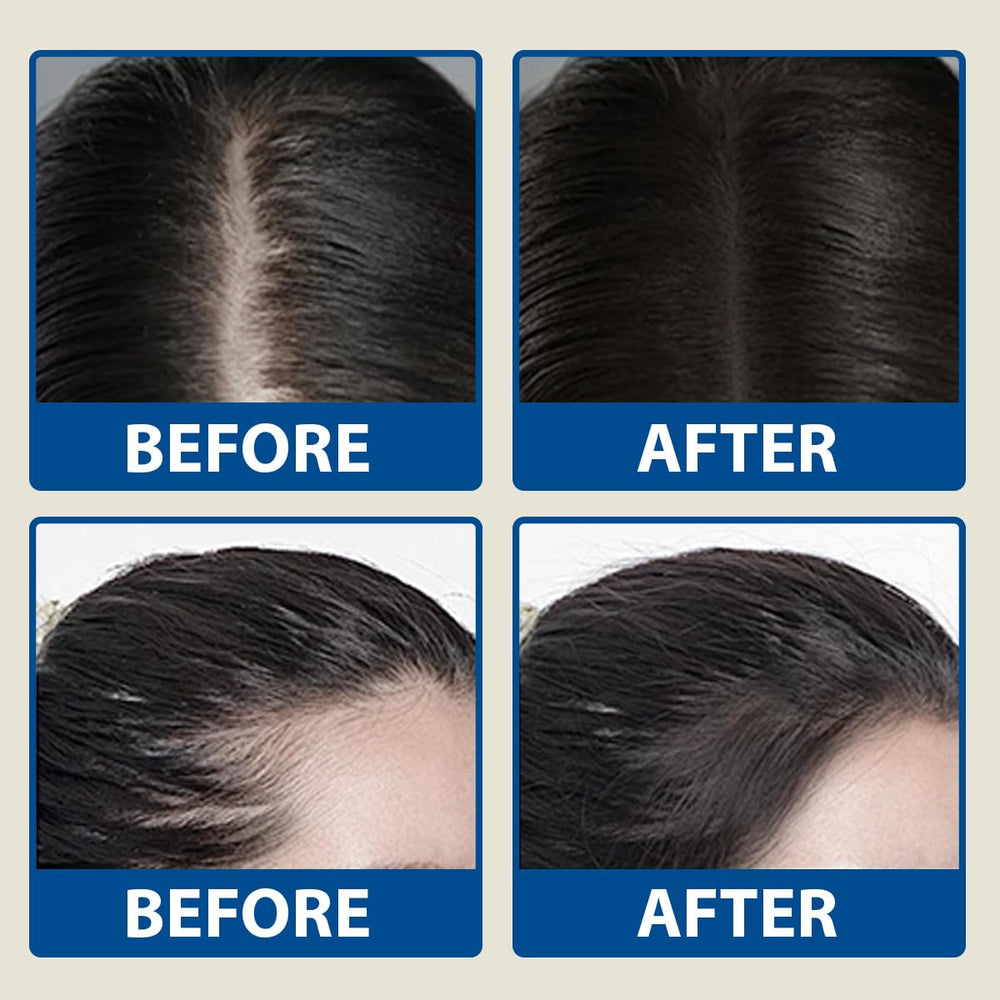 BYXE Redensyl and Anagain formula close-up highlighting ingredients