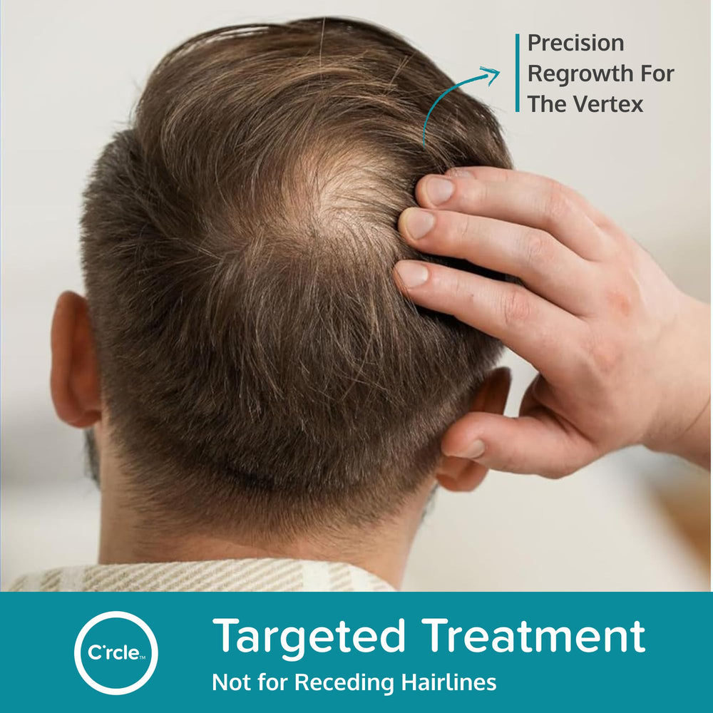 C'rcle Minoxidil 5% Foam with precise dosing pump for controlled application