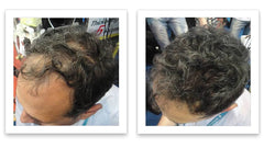 Caboki fibers blend with thinning areas for natural coverage.