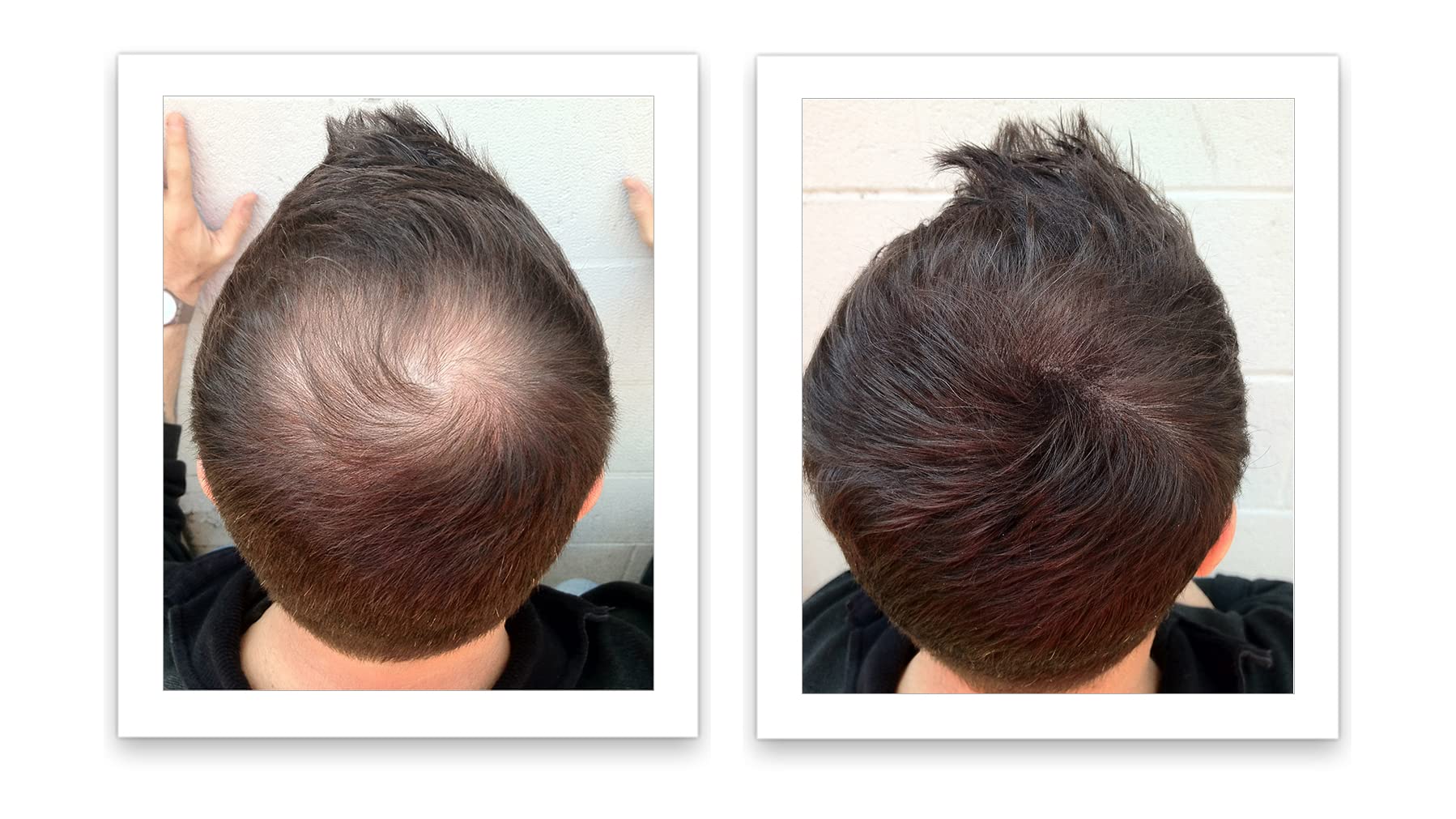 Caboki application step: shake powder onto thinning area for instant coverage.