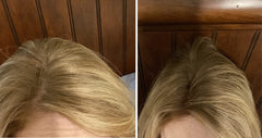 Caboki concealer widens the part for a fuller look.