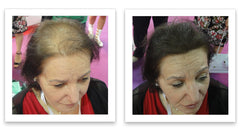 Caboki thinning-area concealment demonstrates fibers blending with existing hair for fuller look.