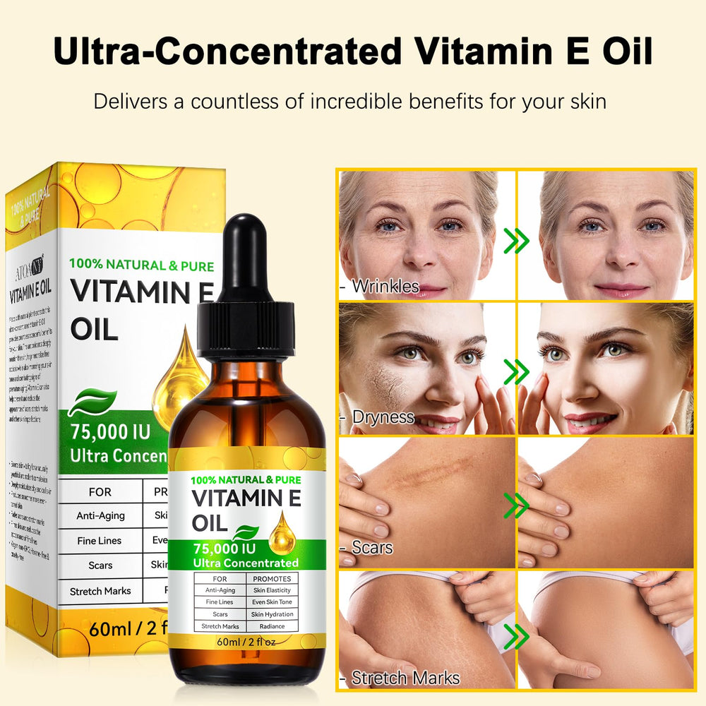 Cacukn Vitamin E Oil on scars for a more even texture.
