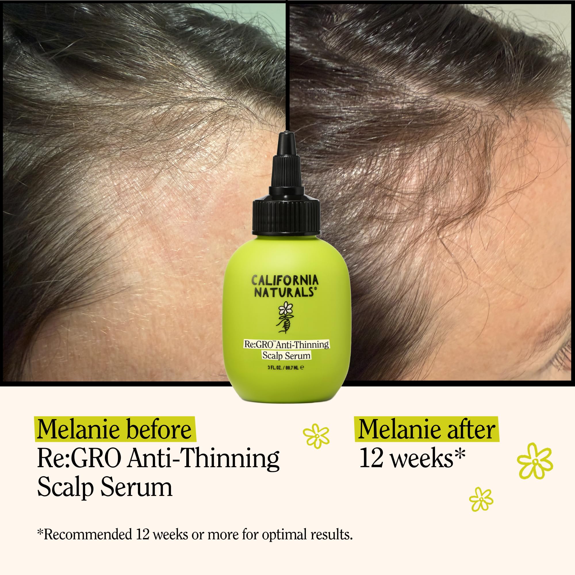 Dropper of California Naturals Re:GRO serum ready for precise scalp application