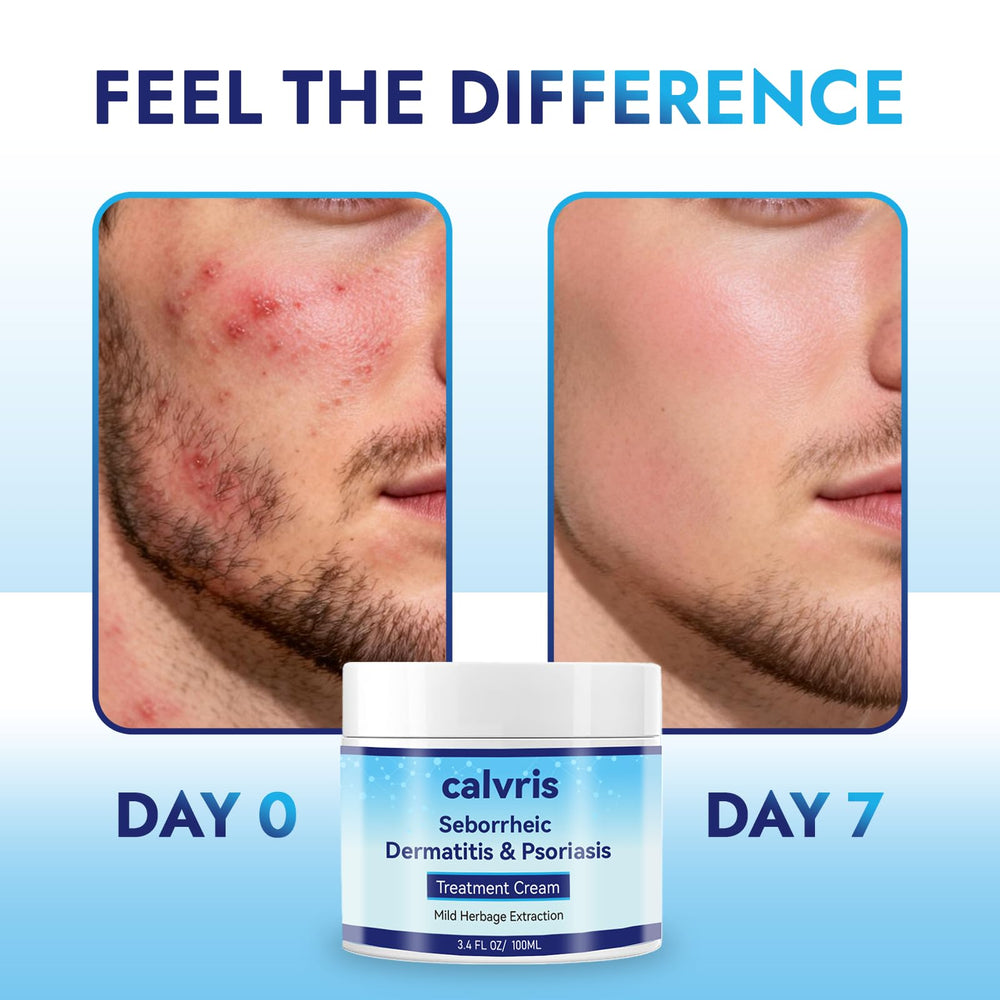 Calvris balm ingredients featuring glycerin, kudzu and goldthread for gentle soothing.
