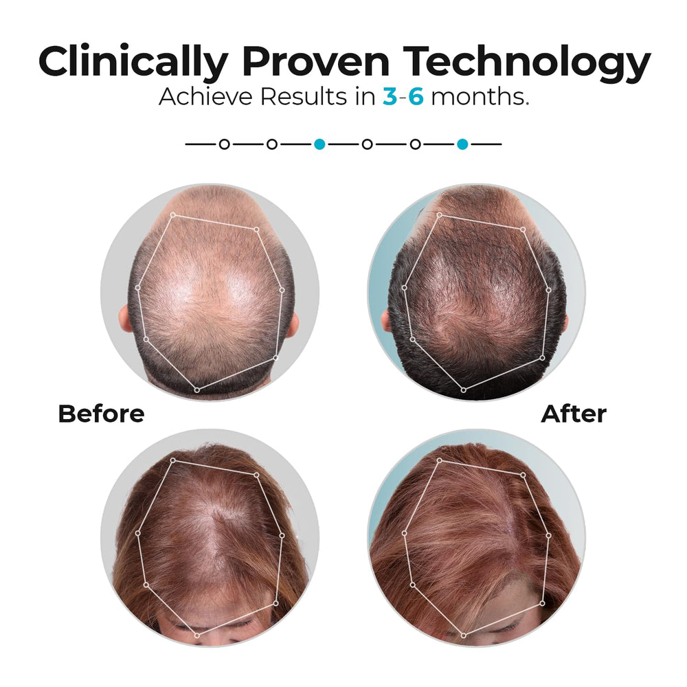 Capillus Pro 272 lasers close-up showing diode grid for targeted scalp stimulation.