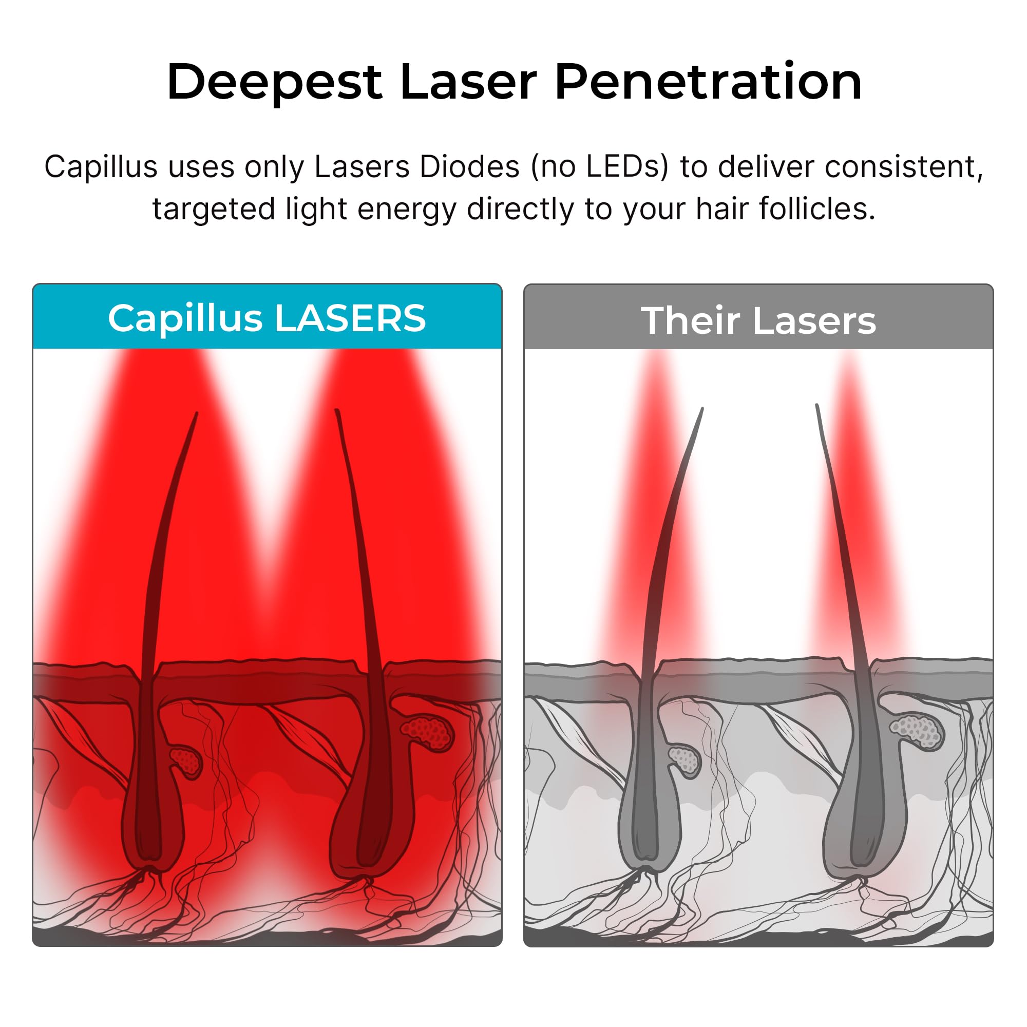 Capillus PRO at-home red-light therapy for convenient care