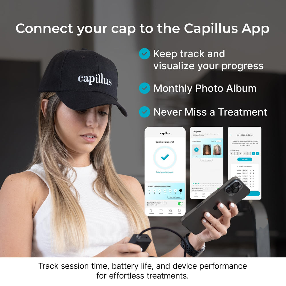 Capillus Pro S1 rechargeable battery enables cordless use.