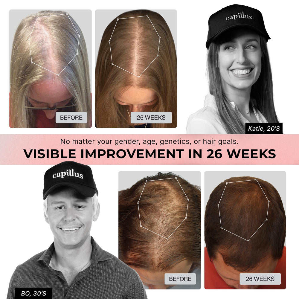 Capillus Pro S1 worn on the head during a daily commute for discreet therapy.