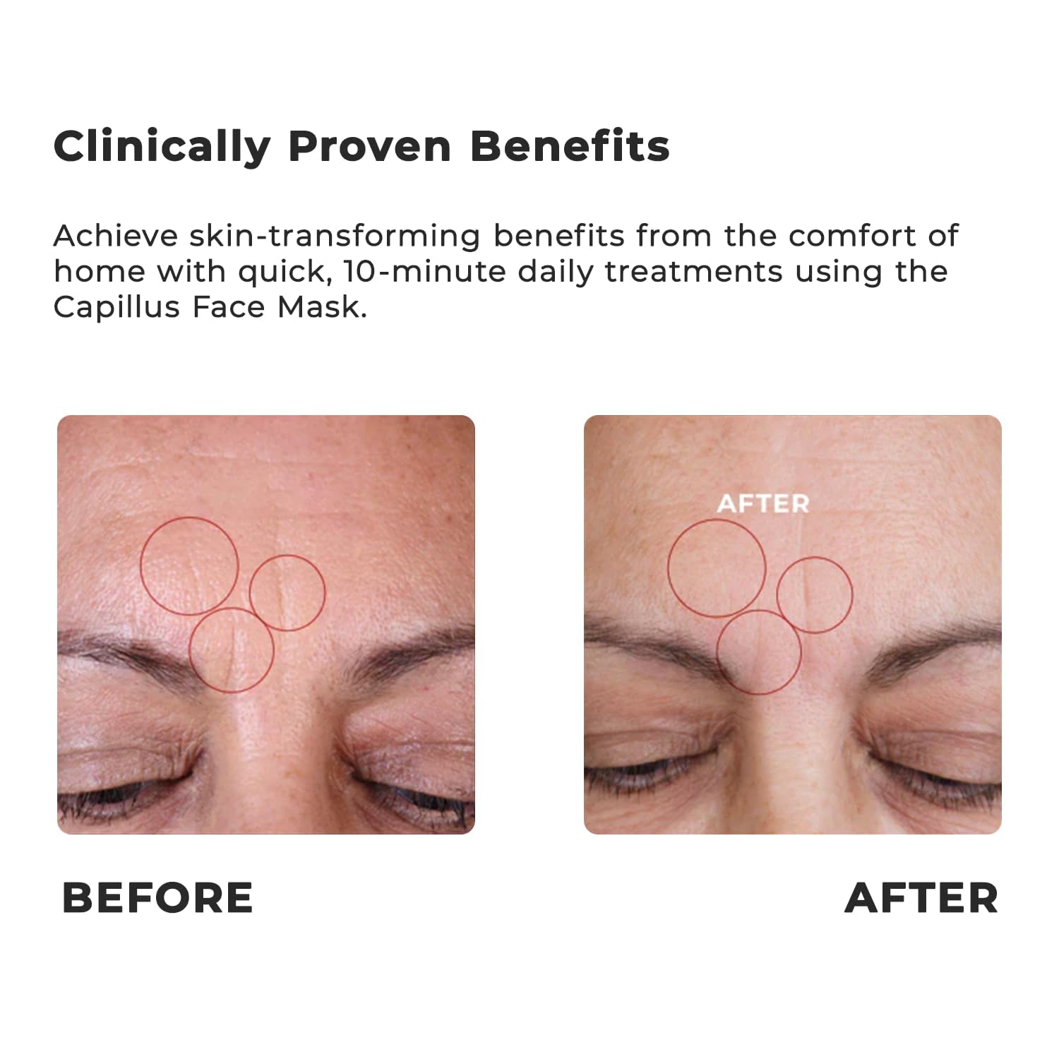 Capillus red blue pink LED spectrum visible on the mask for versatile therapy.