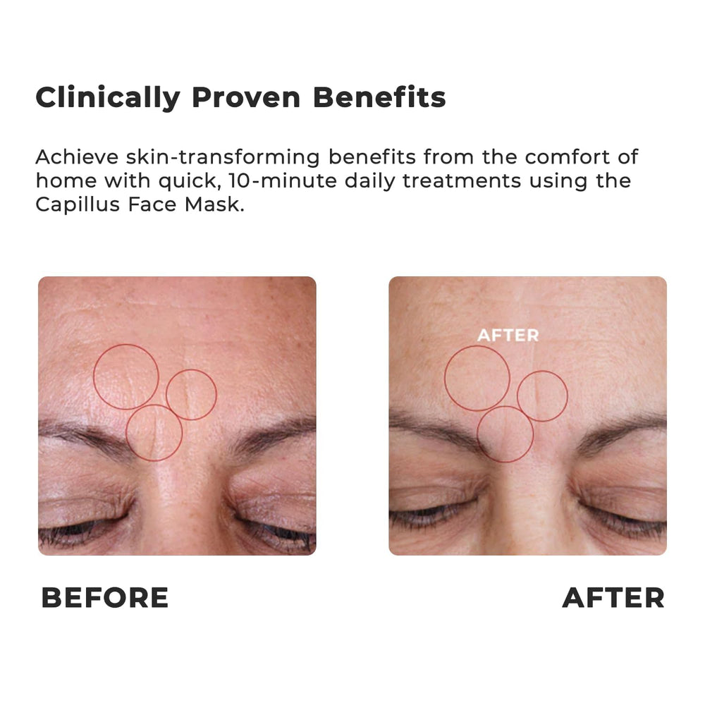 Capillus red blue pink LED spectrum visible on the mask for versatile therapy.