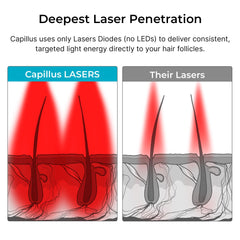 Capillus Spectrum diode cluster close-up highlights laser array.
