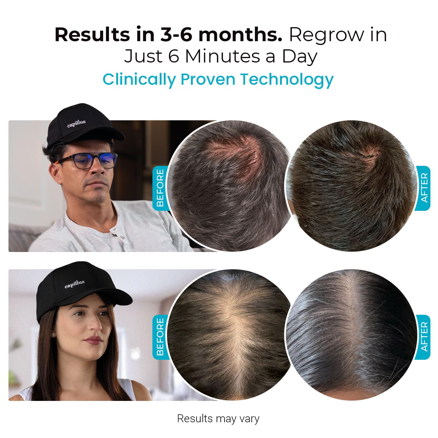 Capillus Spectrum side view shows wearable cap design for daily use.