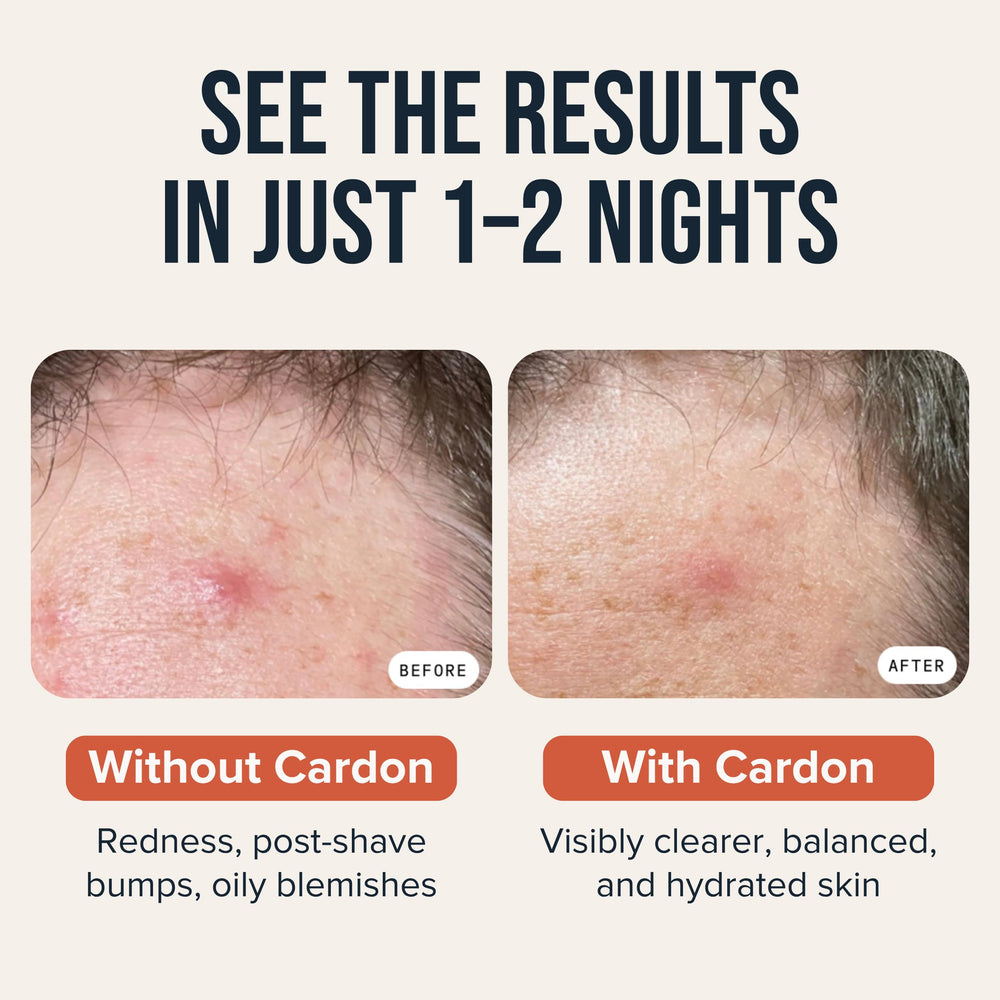 Cardon patch showing ingredients: salicylic acid, niacinamide, hyaluronic acid.