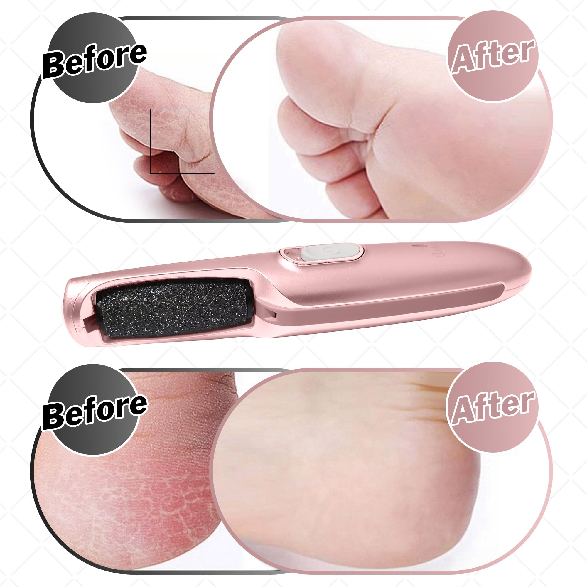 Care Me two-speed control for customizable foot care sessions.