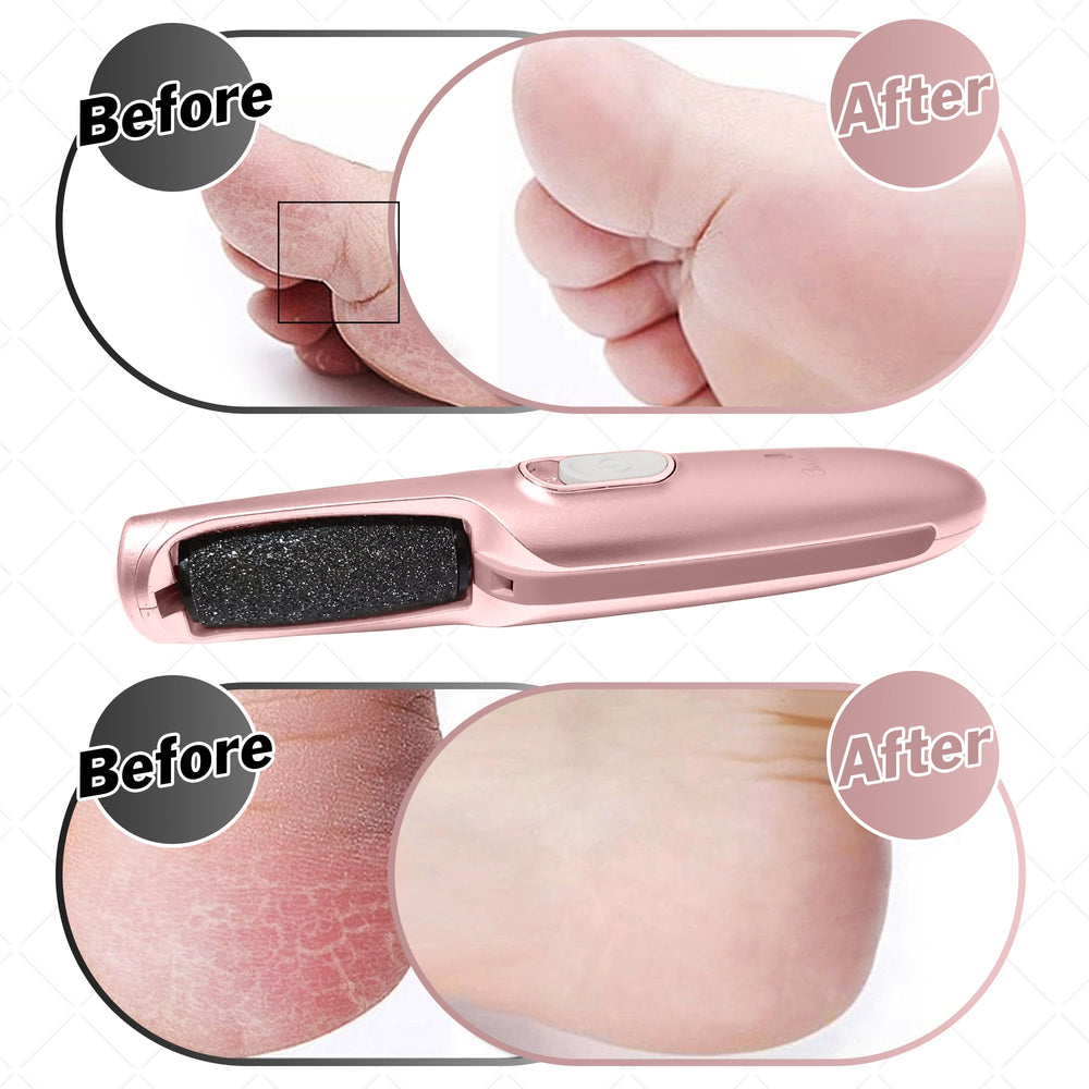 Care Me two-speed control for customizable foot care sessions.