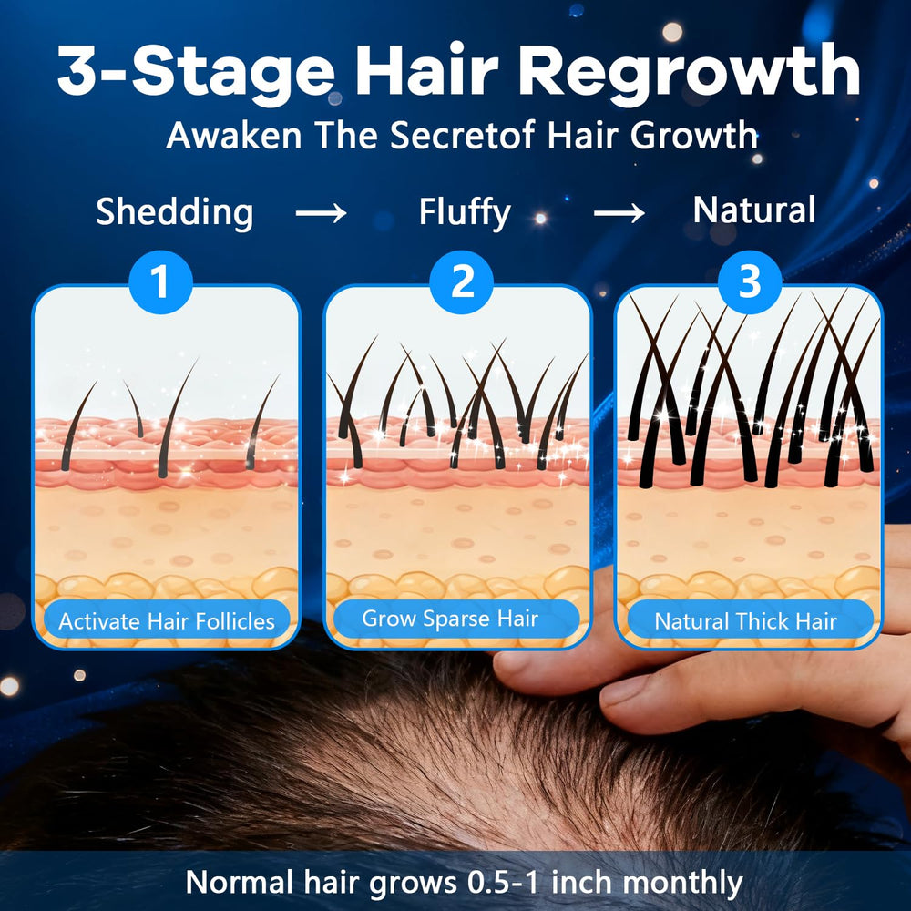 CARENICE Minoxidil Foam for beard application enables simple grooming touch-ups