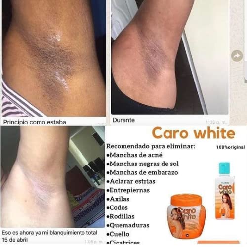Caro White Set-3 soap bar image emphasizes gentle cleansing and hydrated skin daily.