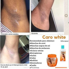 Caro White Set-3 soap bar image emphasizes gentle cleansing and hydrated skin daily.