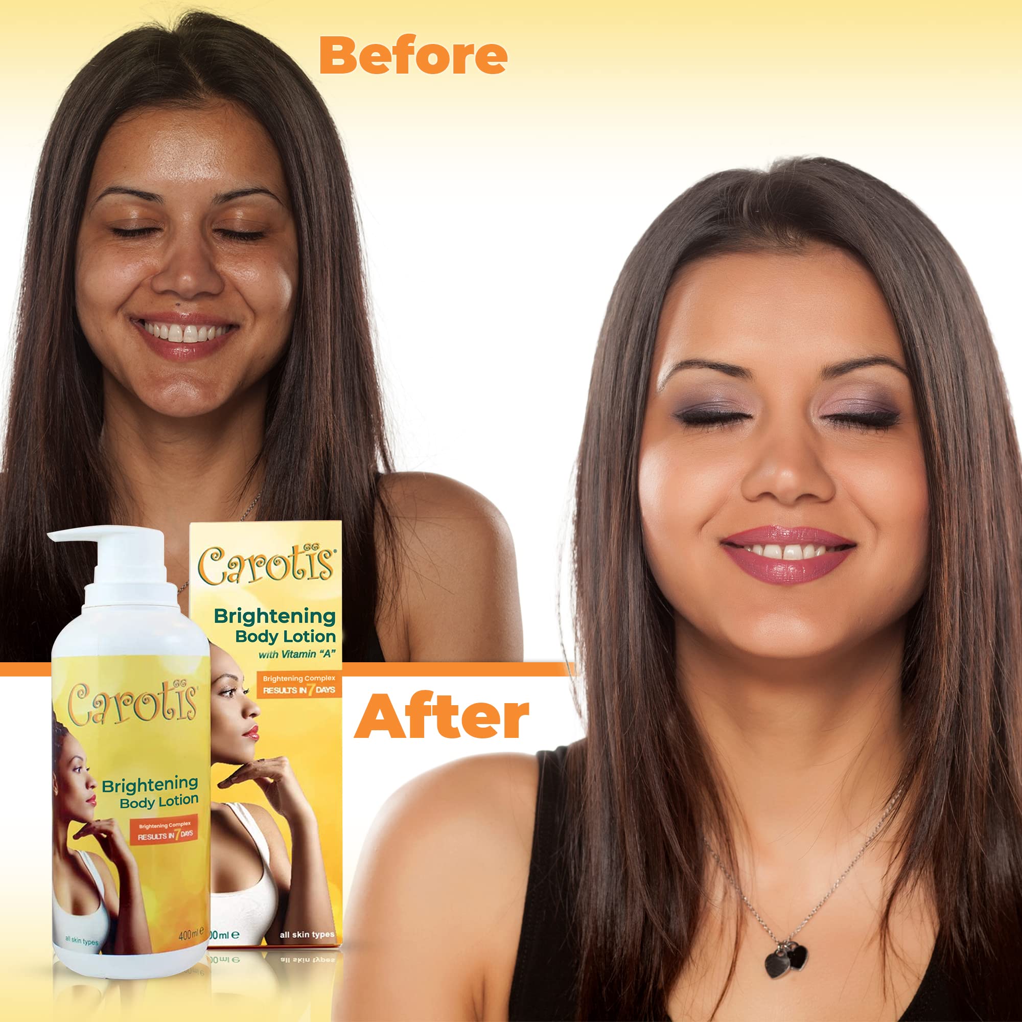 CAROTÏS Skin Brightening Lotion on knees and elbows for smoother, unified appearance.