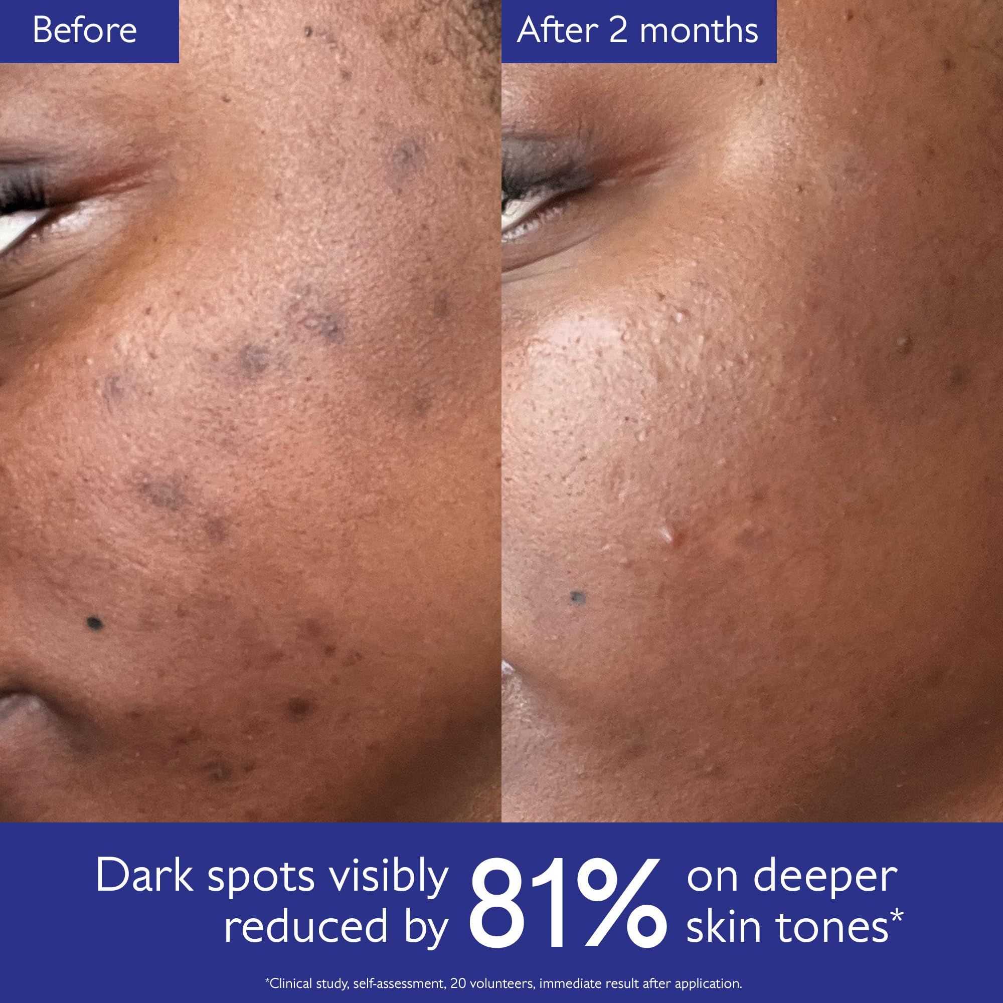 Olive squalane hydration provides non-greasy moisture in the formula.