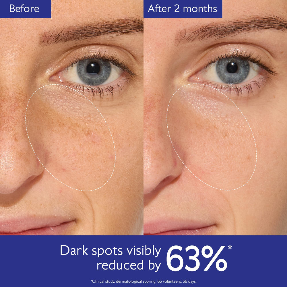 Caudalie Vinoperfect viniferine ingredient highlights dark spot targeting.