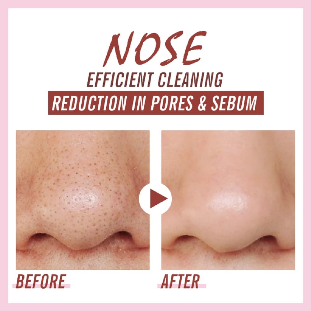 Caunmy pore unclogging action promotes smoother skin.