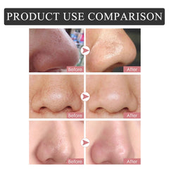 Caunmy strip on the nose demonstrates easy weekly application.